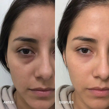 CONTORNO DE OJOS CON ELASTINA Y COLAGENO