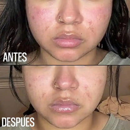 CREMA  DR. ALTHEA 345 RELIEF
