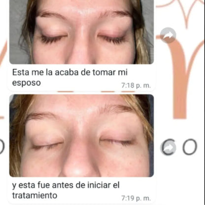 Sérum para Cejas y Pestañas