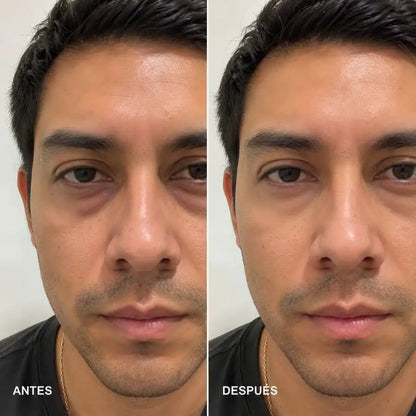 CONTORNO DE OJOS CON ELASTINA Y COLAGENO