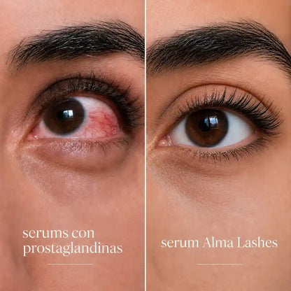 SERUM ALMA LASHES (V2)