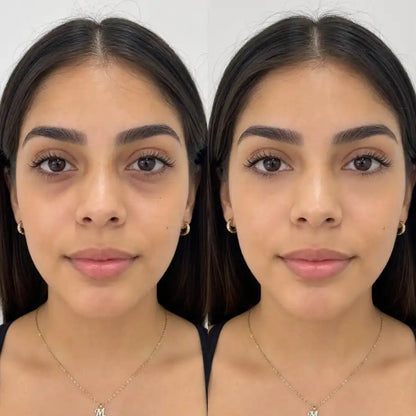 Antes y después del uso de contorno de ojos para mejorar la apariencia de ojeras, bolsas y mirada cansada.