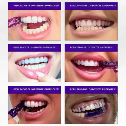 SMILEKIT SMILE CINTA BLANQUEADORA DIENTE